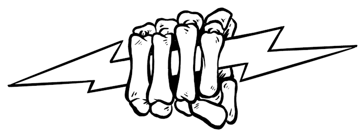 Lightning Skeletal Hand